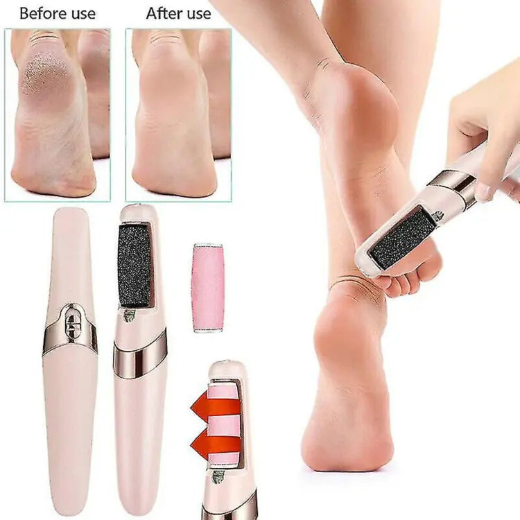 Premium Electric Foot Callous Remover
